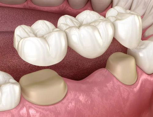 Zahnarztpraxis in Luzern für komfortable, moderne Zahnmedizin