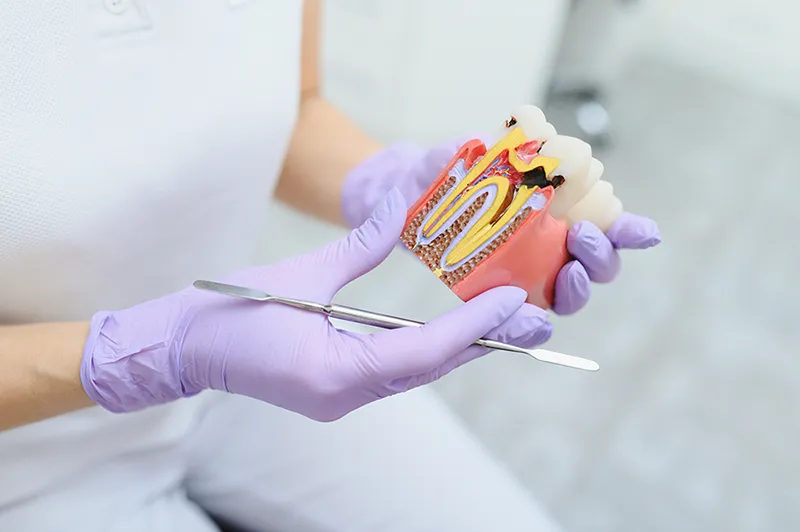 endodontie-wurzelbehandlung