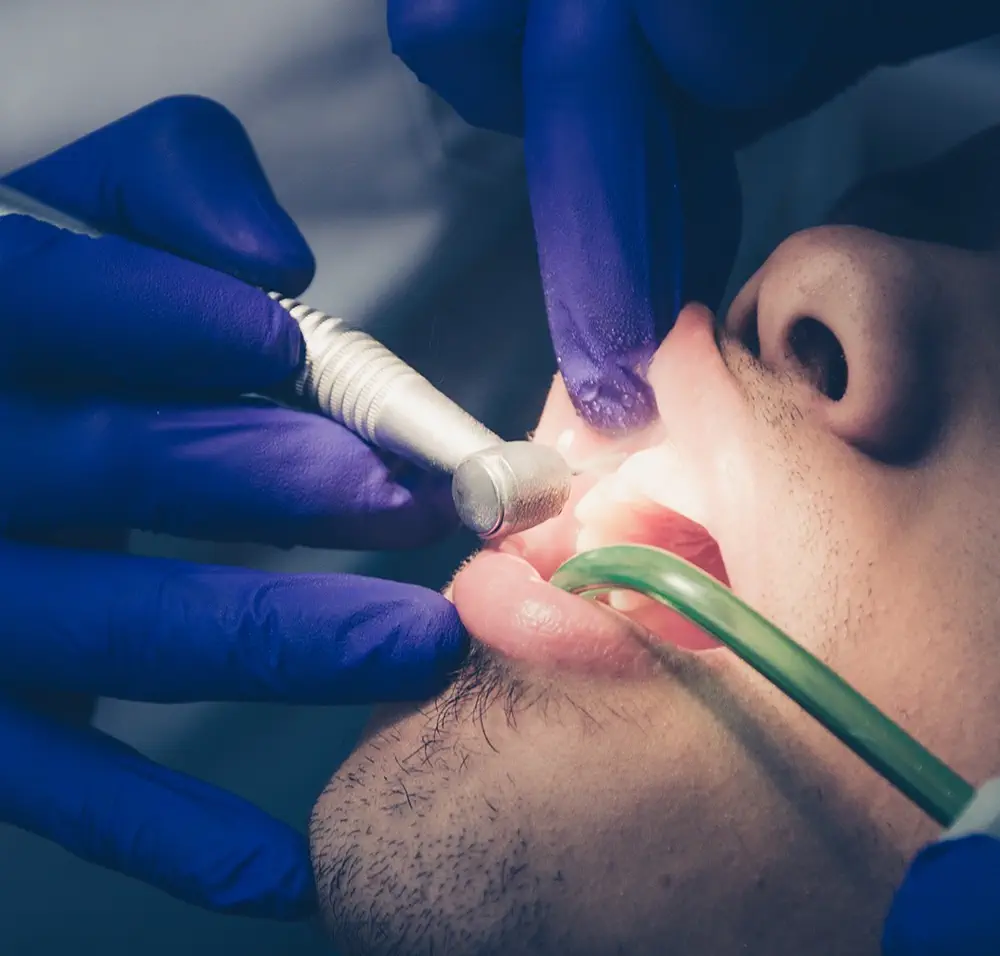 endodontie-in-horw-zahnarztpraxis-2