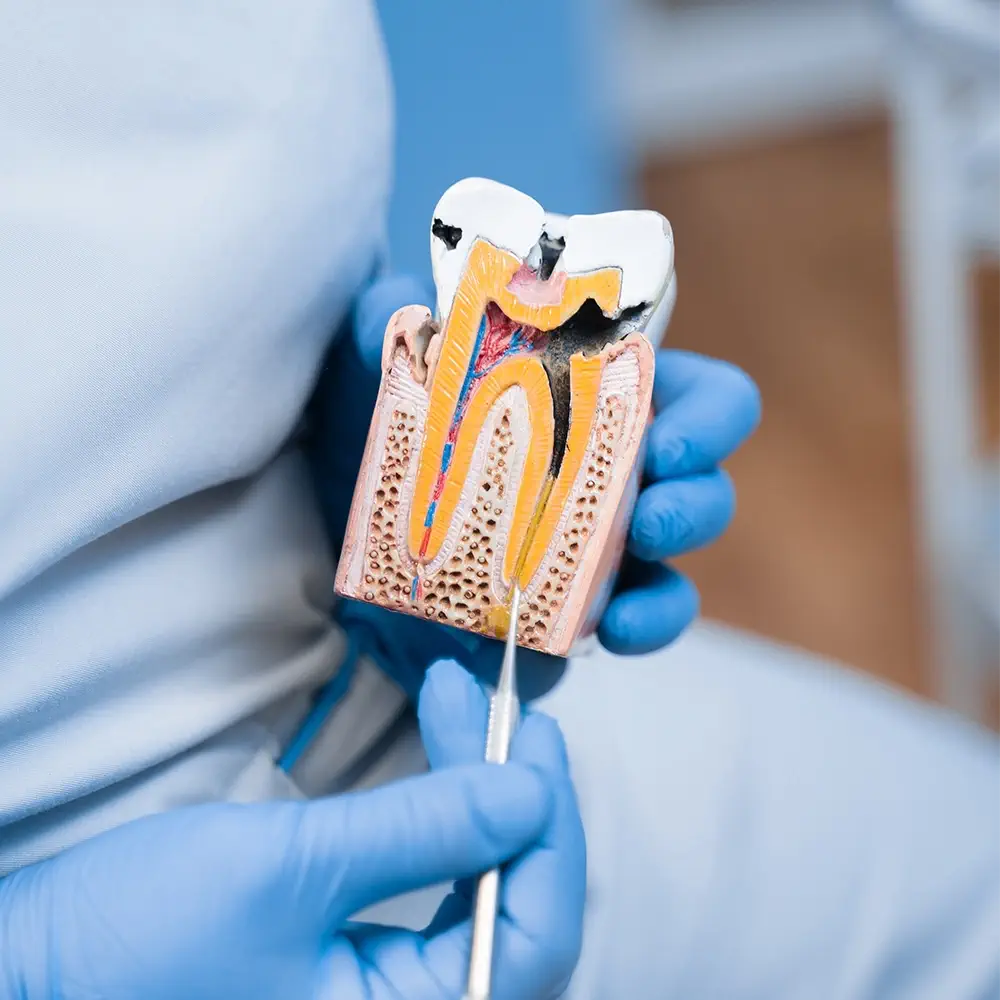 endodontie-in-horw-zahnarztpraxis