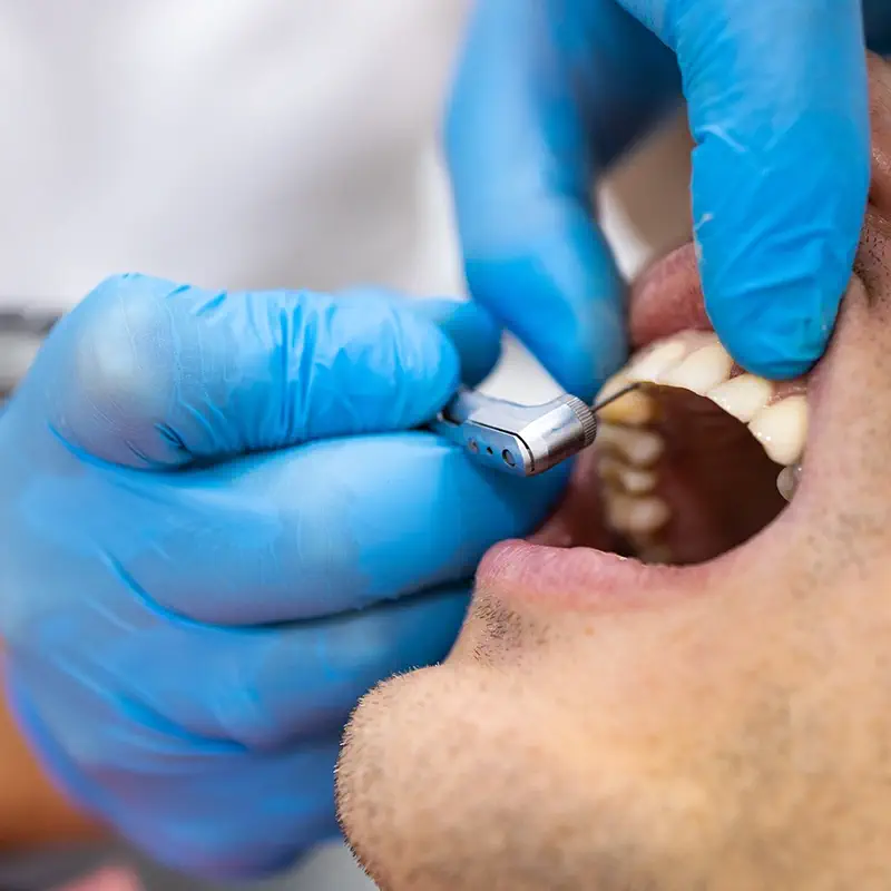 erkrankungen-der-mundhoehle-2